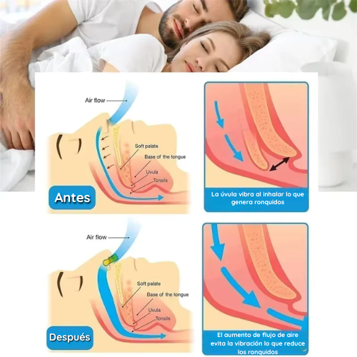 CLIP MAGNETICO NASAL - ADIOS RONQUIDOS